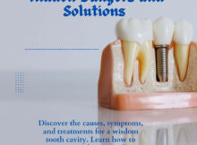 Wisdom Tooth Cavity